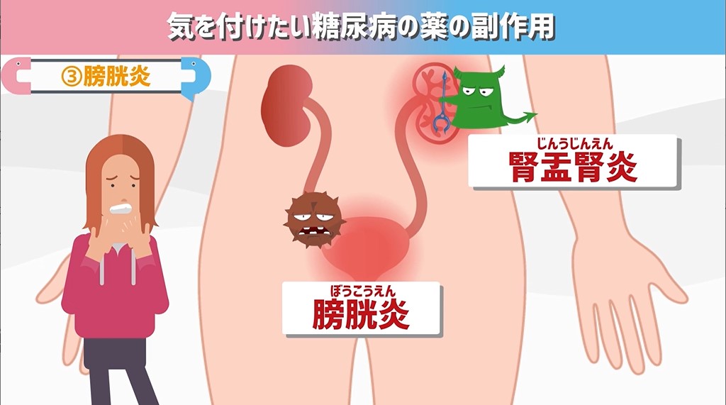 糖尿病　薬　副作用